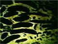 虫歯５